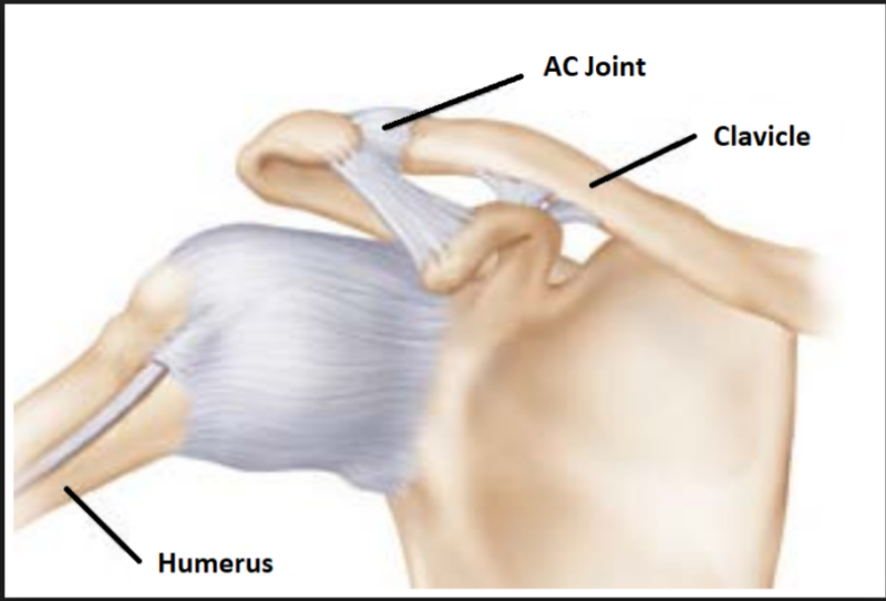 [ 어깨 복합체 ] 봉우리 빗장 관절 - AC Joint 제주PT웅코치 : 네이버 블로그