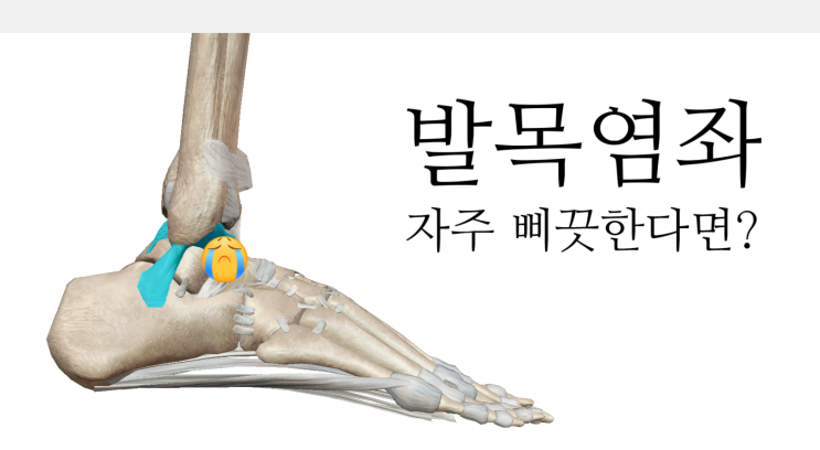 발목 염좌, 발목 삐끗-영통 새움한의원 발목 염좌, 발목 삐끗-영통 새움한의원