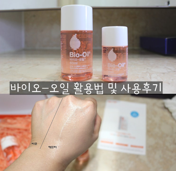  바이오-오일/바디오일추천/바이오오일활용법/보습오일
