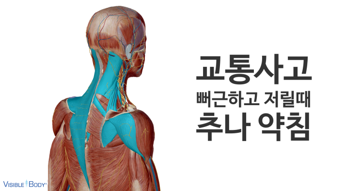 영통교통사고 병원-야간진료, 주차완비(수원영통새움한의원)