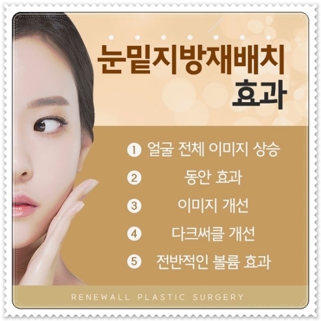 눈 밑 지방 재배치 주사, 병원마다 다른 효과는 무엇일까.