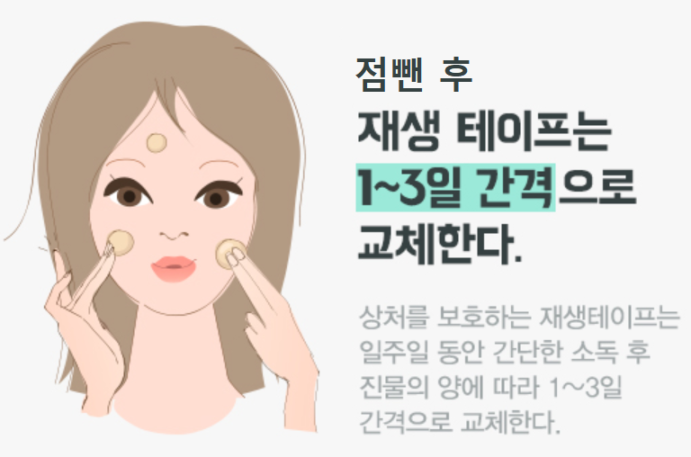 점뺀 후 재생테이프 / 점빼고 메디폼?듀오덤? : 네이버 블로그