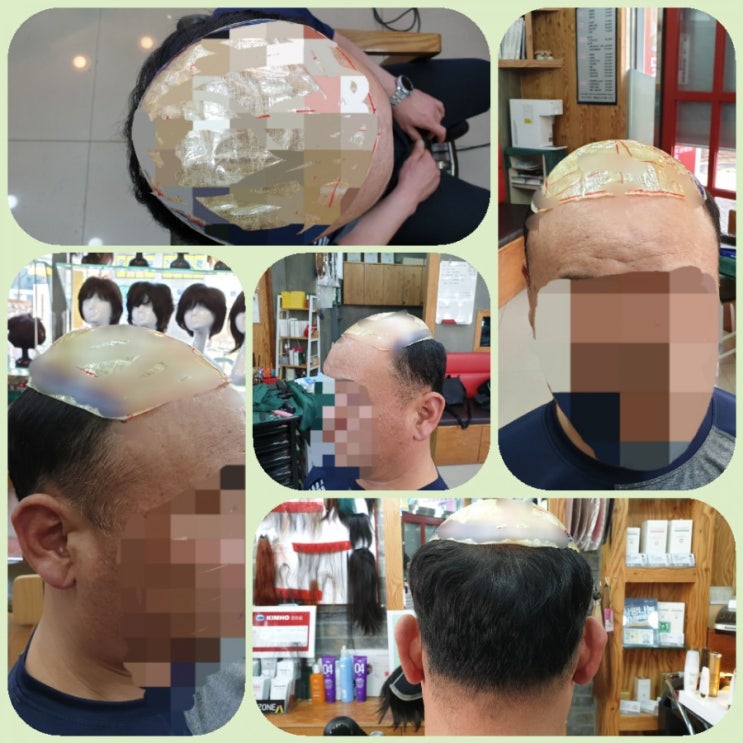  춘천가발 김호증모 이은주헤어살롱 군인고정식가발 본뜨기