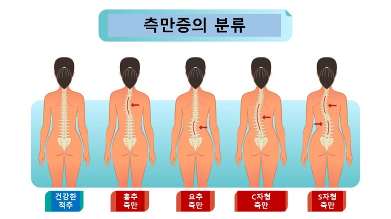 키키키키 이미지