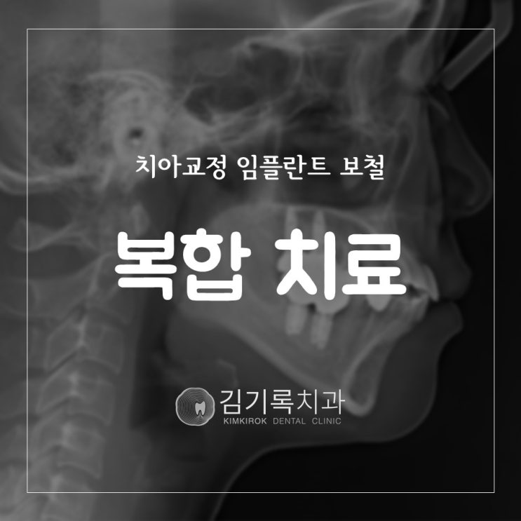 수원영통교정임플란트 임플란트 치아교정 보철치료가 모두 필요한 복합케이스 같이 치료하는 경우