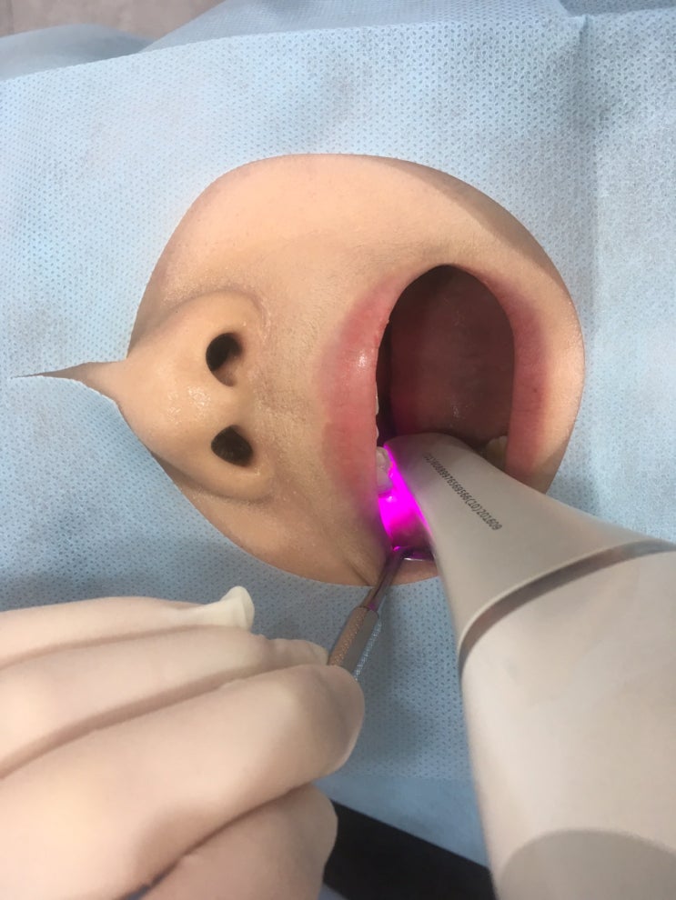  서산치과) 구식은 가라! 교정도 스마트하게 3D 구강스캐너로