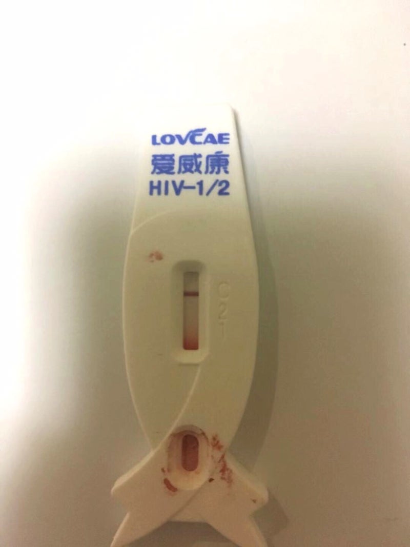 중국의 HIV 감염 위험과 단순 검사 시약 구매