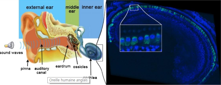 청력 복구 유전자 치료
