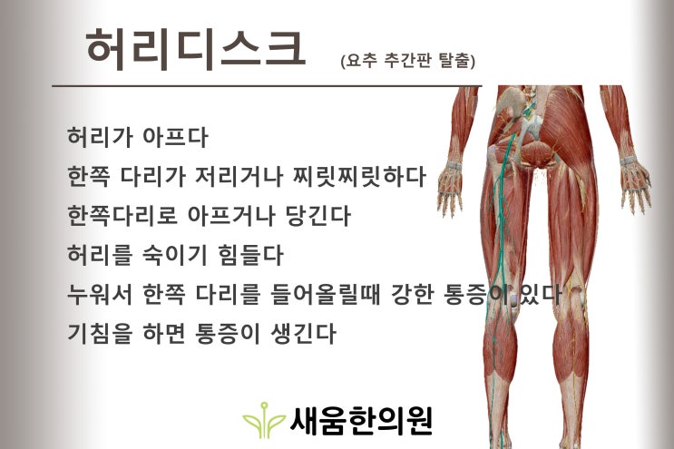 허리디스크-다리가 당기고 저려요(영통 새움한의원) 허리디스크-다리가 당기고 저려요(영통 새움한의원)