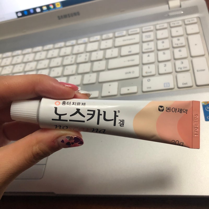 점을 제거하고 재생 크림을 빠르게 회복하는 요령 1