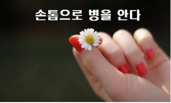  손톱 세로줄 등 손톱으로 병을 안다 