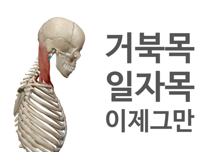 수원 영통 거북목, 일자목 치료 수원 영통 거북목, 일자목 치료