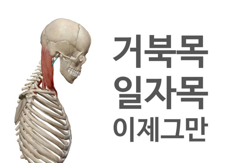 수원 영통 거북목, 일자목 치료