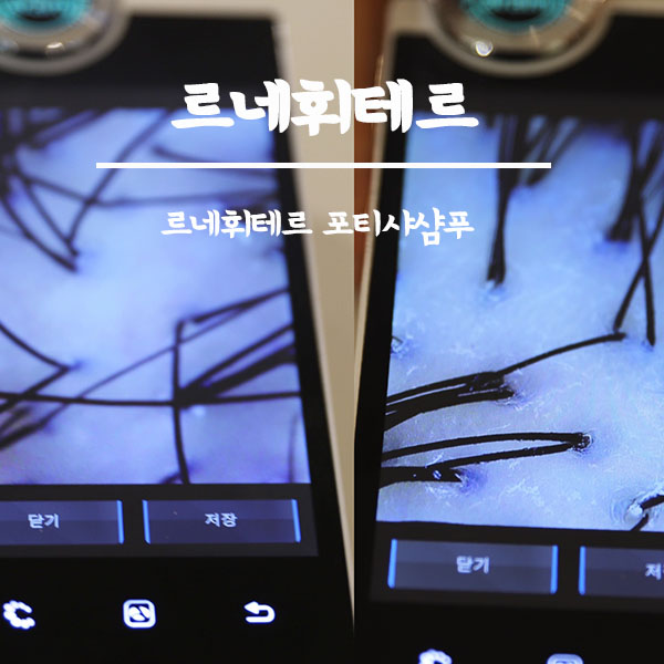  내 두피상태 확인하고 건강하게 르네휘테르 포티샤샴푸 사용하자