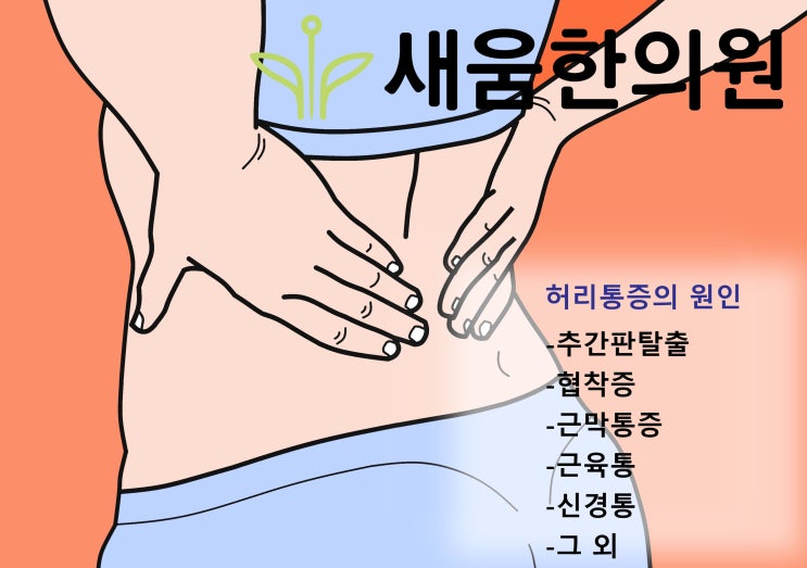 영통 서천동 한의원)요통엔 침치료!