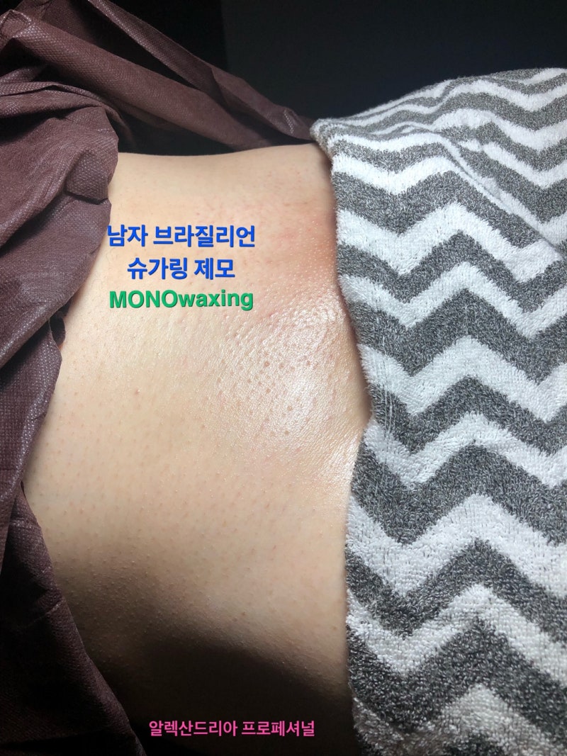 실사첨부) 여자친구 남자친구 특별한 생일선물 브라질리언 왁싱을 선택! 광주 모노왁싱 : 네이버 블로그