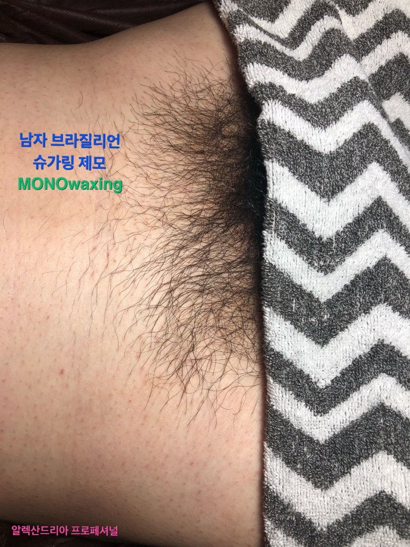 실사첨부) 여자친구 남자친구 특별한 생일선물 브라질리언 왁싱을 선택! 광주 모노왁싱 : 네이버 블로그