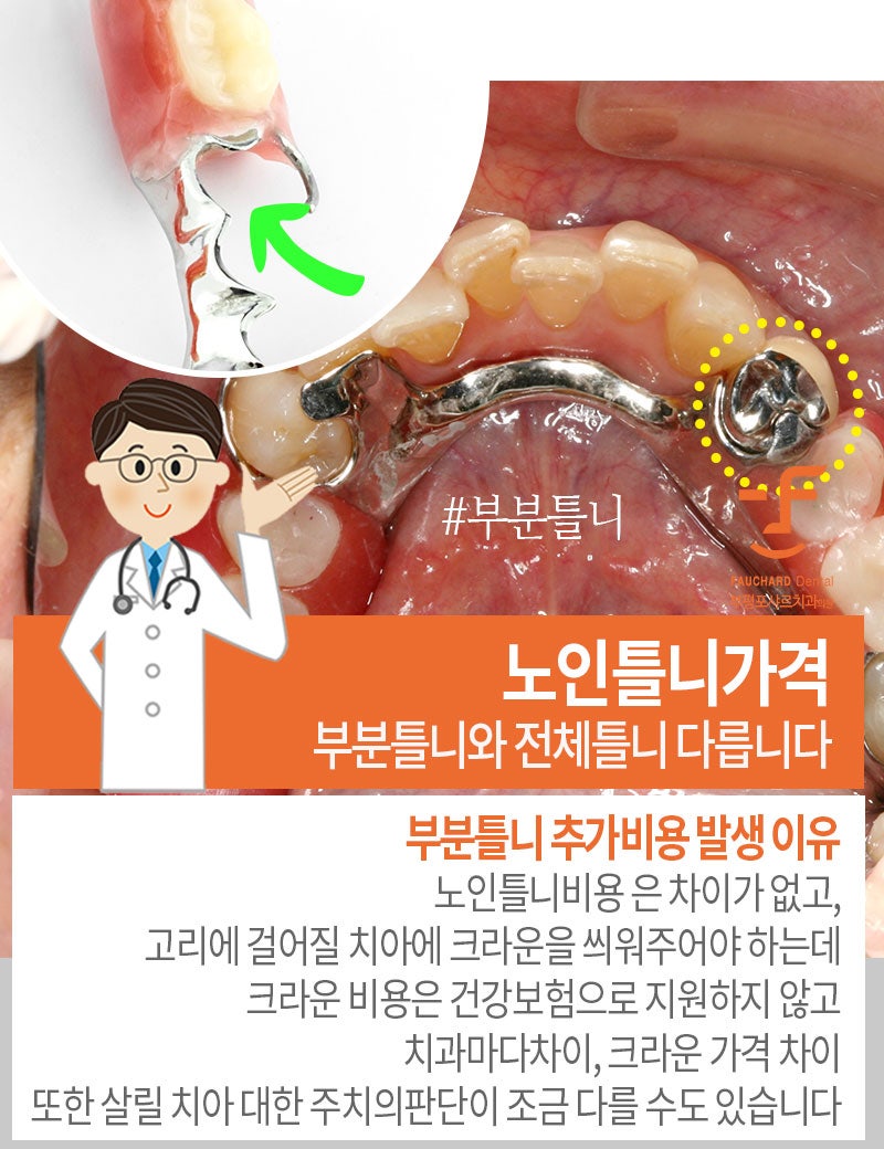 치아가 많이 빠진 경우 틀니를 착용하십시오.