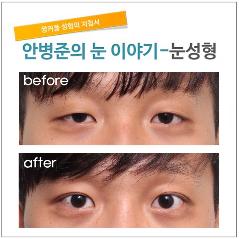 남자 짝눈 : 네이버 블로그 남자 짝눈 : 네이버 블로그