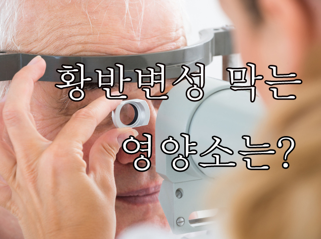  황반변성 위험 막는 영양제, 루테인 지아잔틴 중요합니다