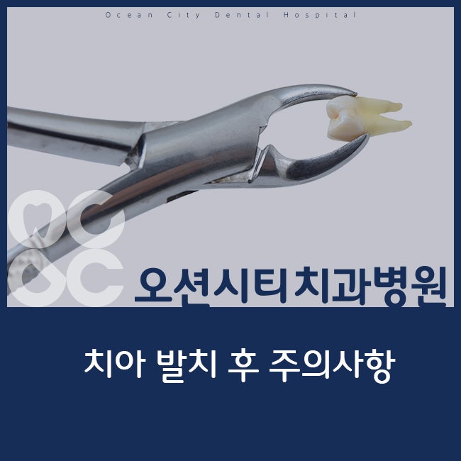 치아 발치 후 주의사항 : 네이버 블로그
