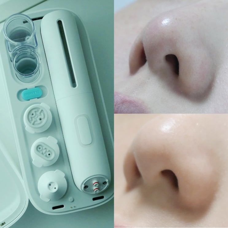  각질관리 시작! 유티아 아쿠아필링기 사용해봄~