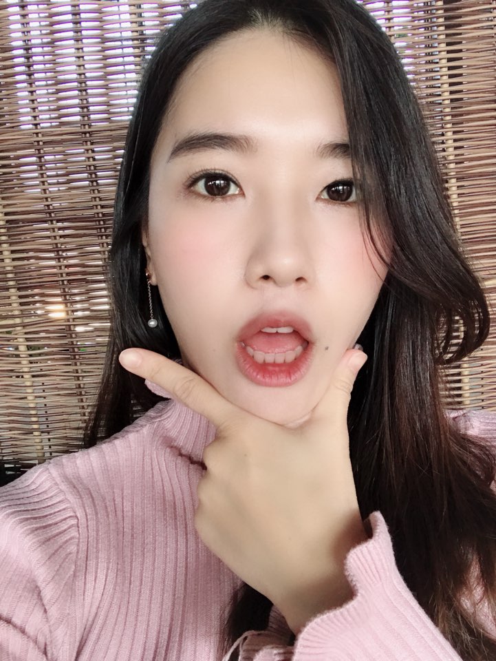  0318 빅텍,호텔신라,에이비엘바이오,(셀리버리)