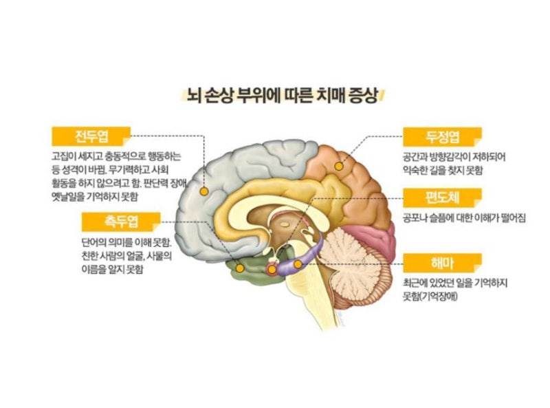 대뇌(대뇌피질)의 기능 및 구조 : 네이버 블로그