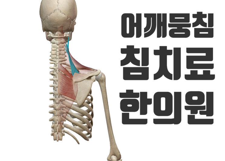 어깨가 늘 무겁고 뭉칠때 빠르게 침치료![영통역 한의원/서천동 한의원]