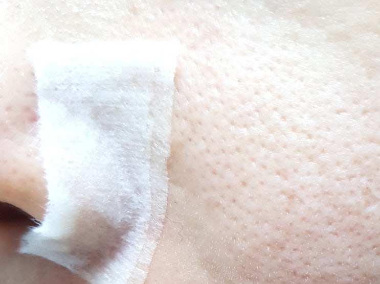  아이허브 미네랄 미스트, 더마부스트 (Derma Boost) 팩! 홍조, 수분에 짱!