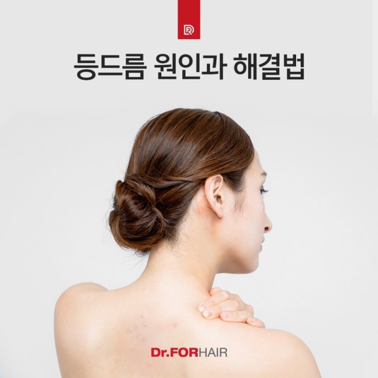 샴푸가 등드름의 원인이 될 수도 있습니다. 샴푸가 등드름의 원인이 될 수도 있습니다.