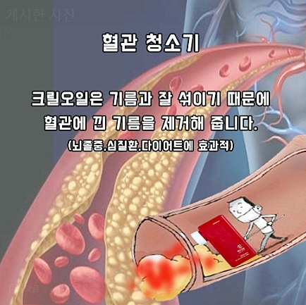  크릴오일추천 강력추천템 입니다!