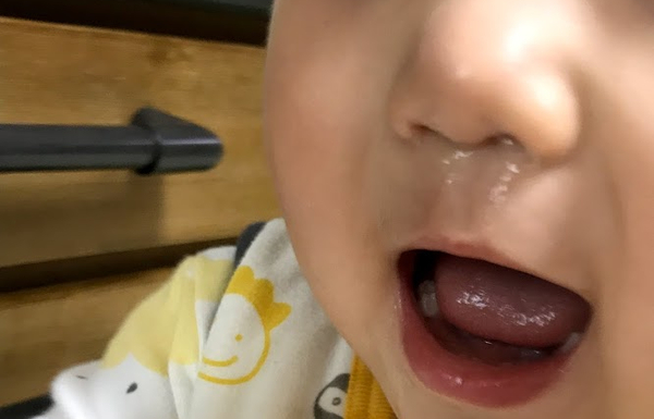 아이 콧물 감기 비염. 감기 끝에 콧물이 계속 흘러요. 형개연교탕으로 좋아졌어요. 아이 콧물 감기 비염. 감기 끝에 콧물이 계속 흘러요. 형개연교탕으로 좋아졌어요.