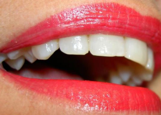 스탠다드 치아미백을 하여 내가 원하는 치아 색상으로 미백 치료가 가능합니다.
