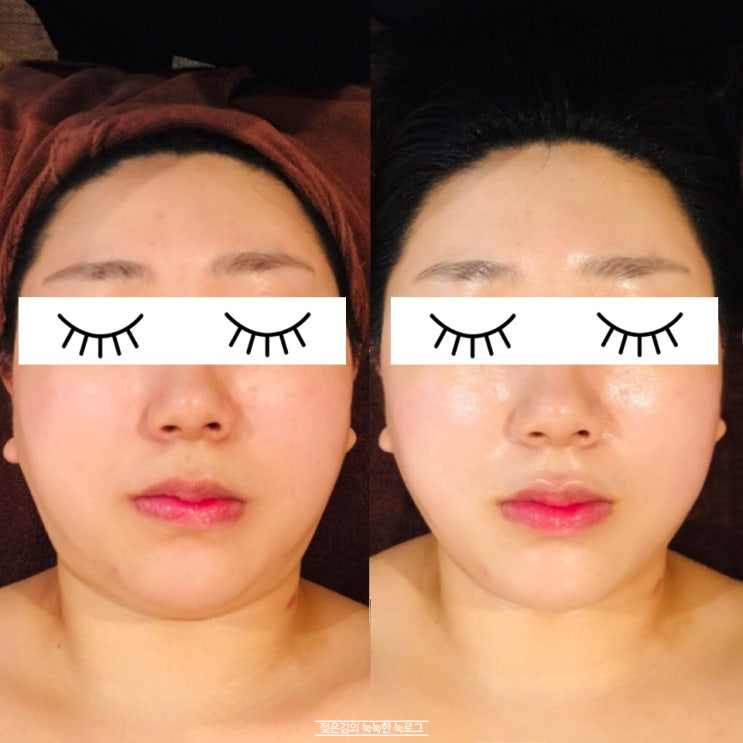 청주피부관리실 경락으로 비대칭 관리 받고옴. 청주피부관리실 경락으로 비대칭 관리 받고옴.