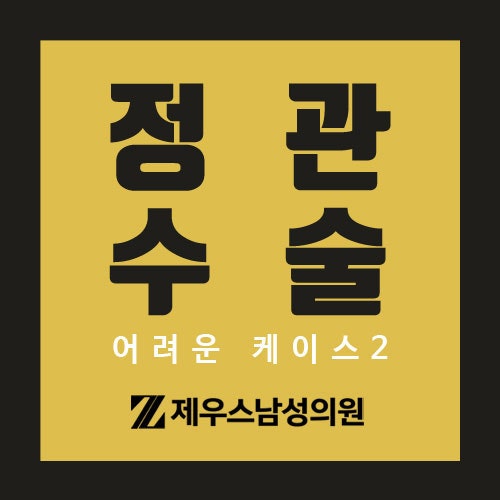 서면정관수술, 제우스남성의원 원장이 전하는 '정관수수술' 아홉 번째 이야기(어려운 케이스....