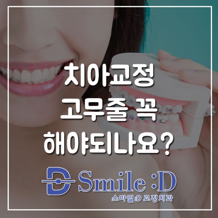 신사역교정치과 치아교정 고무줄 꼭 껴야 하나요?