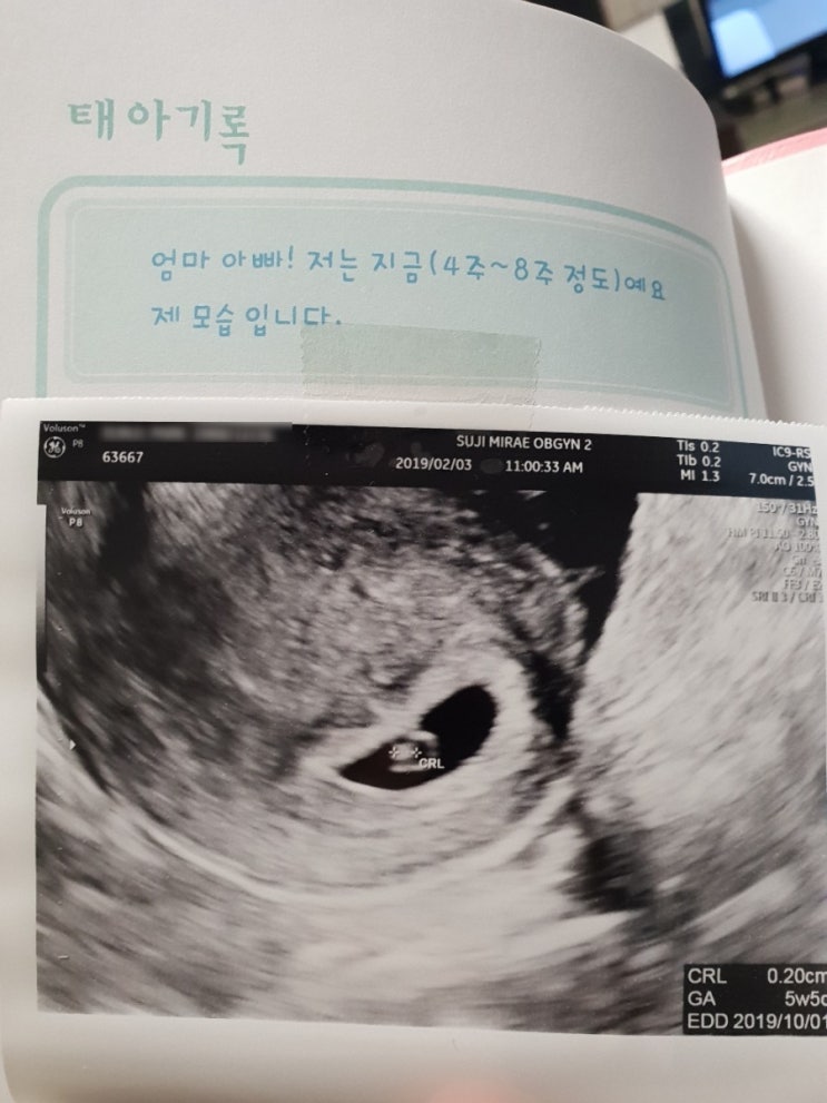  [따콩이 아빠's Diary#1] 임신생활과 남편의 역할 - 임신 4주/5주의 아이를 가졌어요! 임신은 참 벅찬 느낌이에요. : ) 한번 들어보실래요?