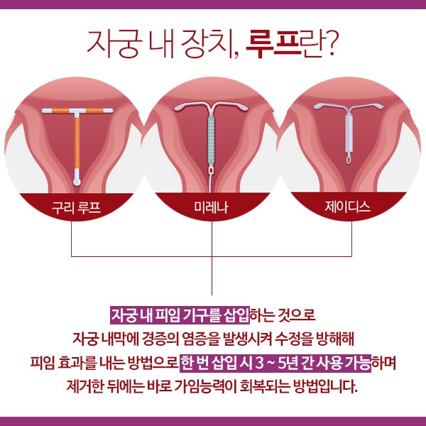 #1161번 현대 쏘나타 DN8 전용 가로바 //툴레 모션 XT XL 루프박스 장착 모습