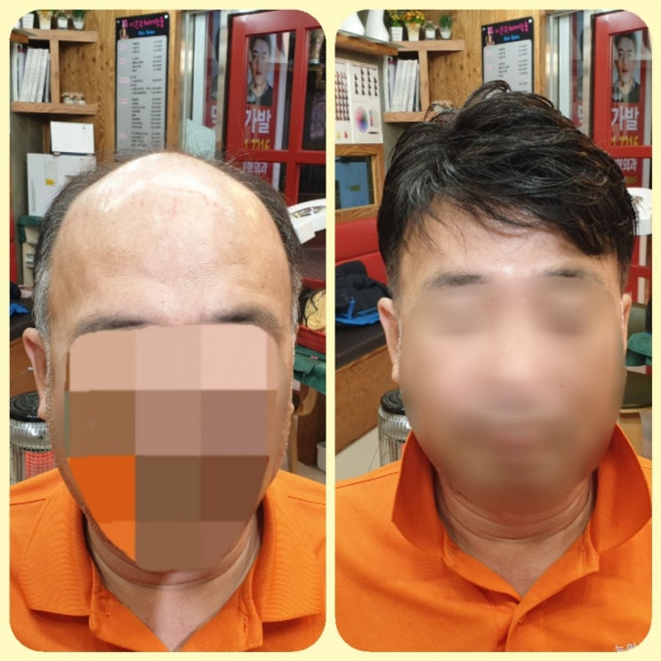  춘천가발 김호증모 이은주헤어살롱에서 봄맞이 남자맞춤가발로 젊음을 찾아드립니다~