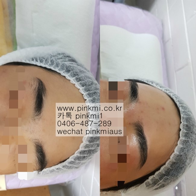  <브리즈번왁싱>핑크미뷰티PINKMI BEAUTY.브리즈번남자왁싱여자왁싱,호주왁싱,브리즈번눈썹왁싱,브리즈번페이스왁싱,브리즈번한인왁싱브라질리언왁싱