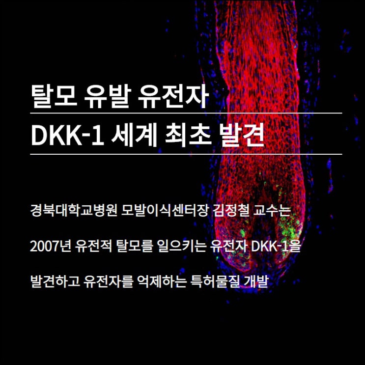 Dkk-1억제 특허 물질은 탈모에 도움이 될 수 있음을 강력히 제시한다(닥터 유지 샴푸)