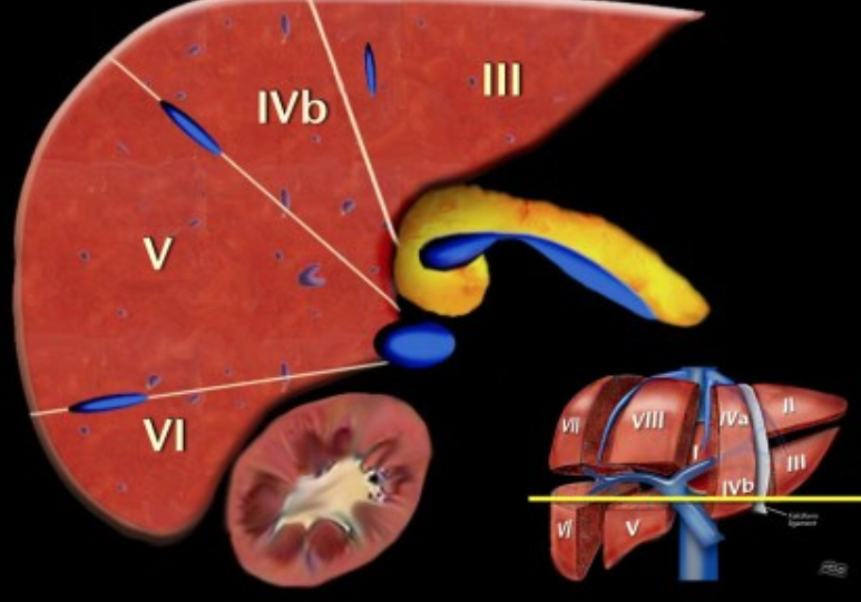 간 엽/분절 해부학(liver lobe/segment anatomy): CT 판독 Couinaud : 네이버 블로그