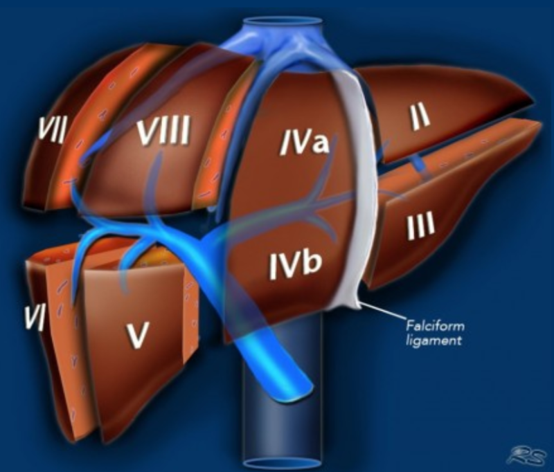 간 엽/분절 해부학(liver lobe/segment anatomy): CT 판독 Couinaud : 네이버 블로그