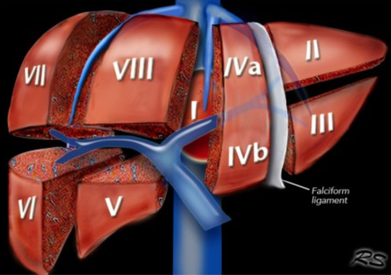 간 엽/분절 해부학(liver lobe/segment anatomy): CT 판독 Couinaud : 네이버 블로그