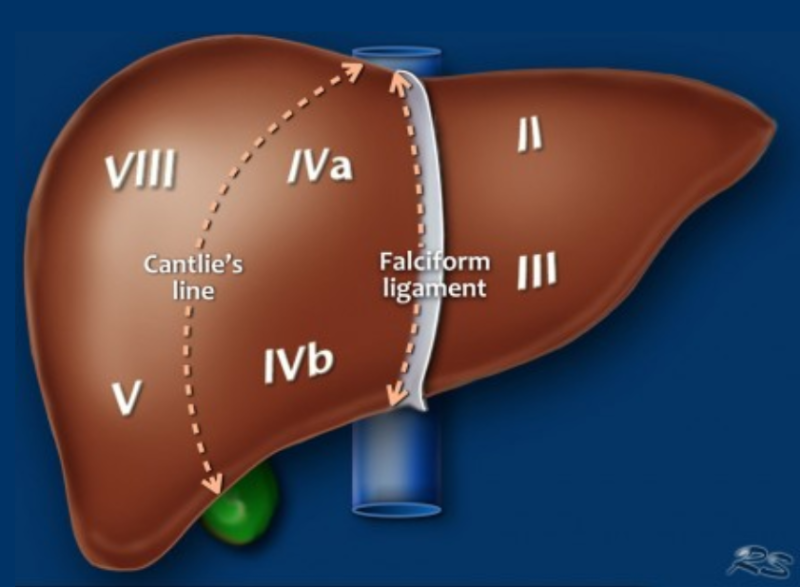 간 엽/분절 해부학(liver lobe/segment anatomy): CT 판독 Couinaud : 네이버 블로그
