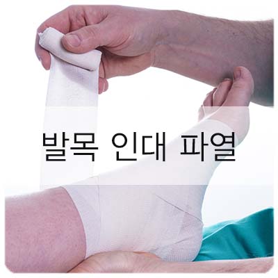  발목인대파열, 치료가 중요한 이유는 바로 이것 때문