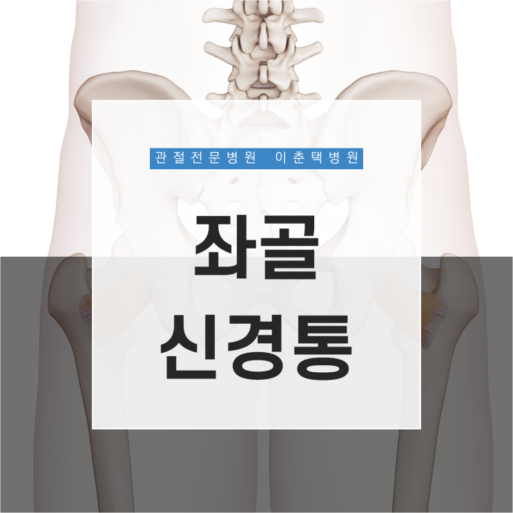  수원 이춘택병원 - 엉덩이부터 다리까지 뻗치는 통증? 좌골신경통 치료는 어떻게