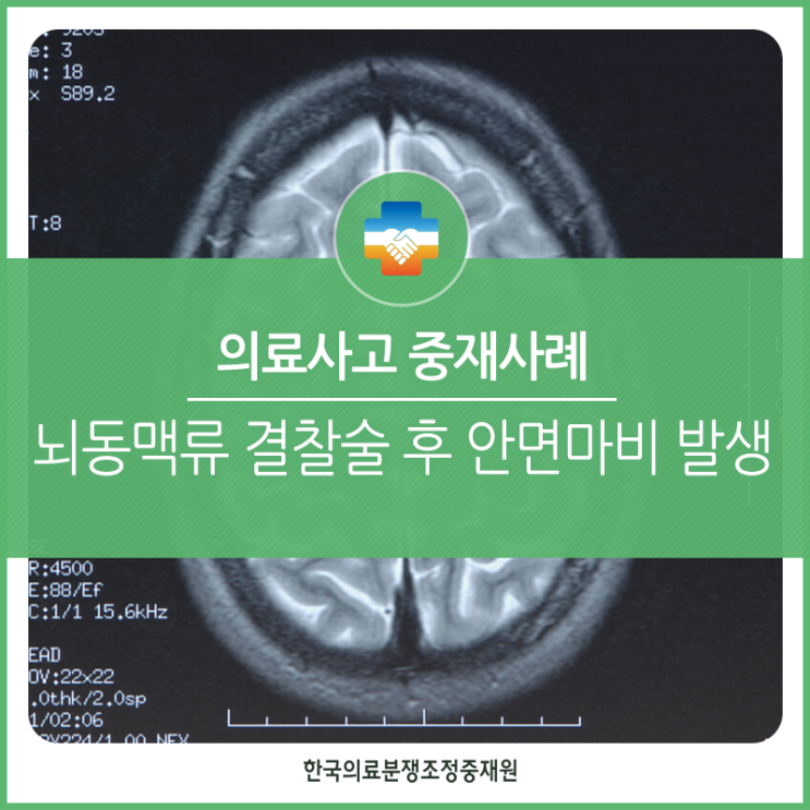  [의료사고중재사례] 뇌동맥류 결찰술 후 안면마비 발생