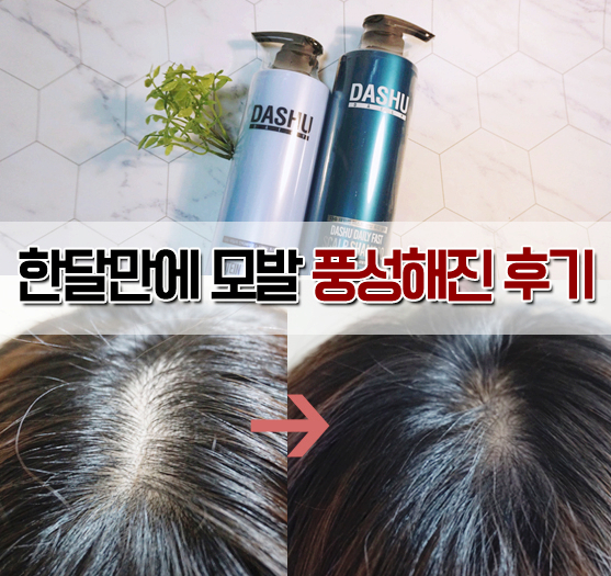  탈모샴푸로 유명한 다슈샴푸 사용후기 여성탈모원인까지